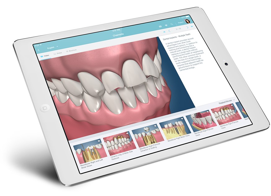 dental-videos-ipad