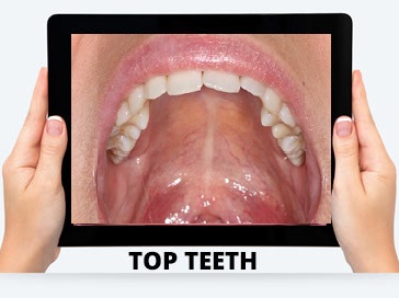 online-dental-consultation-india-vadodara