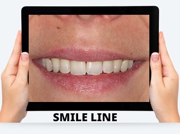 online-dental-consultation-india