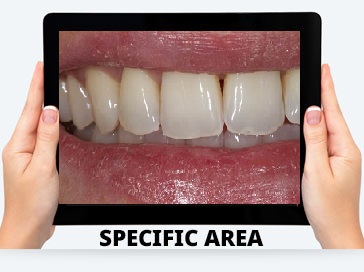 online-dentist-consultation-india-dental-clinic